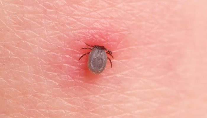 Tick Control Experts